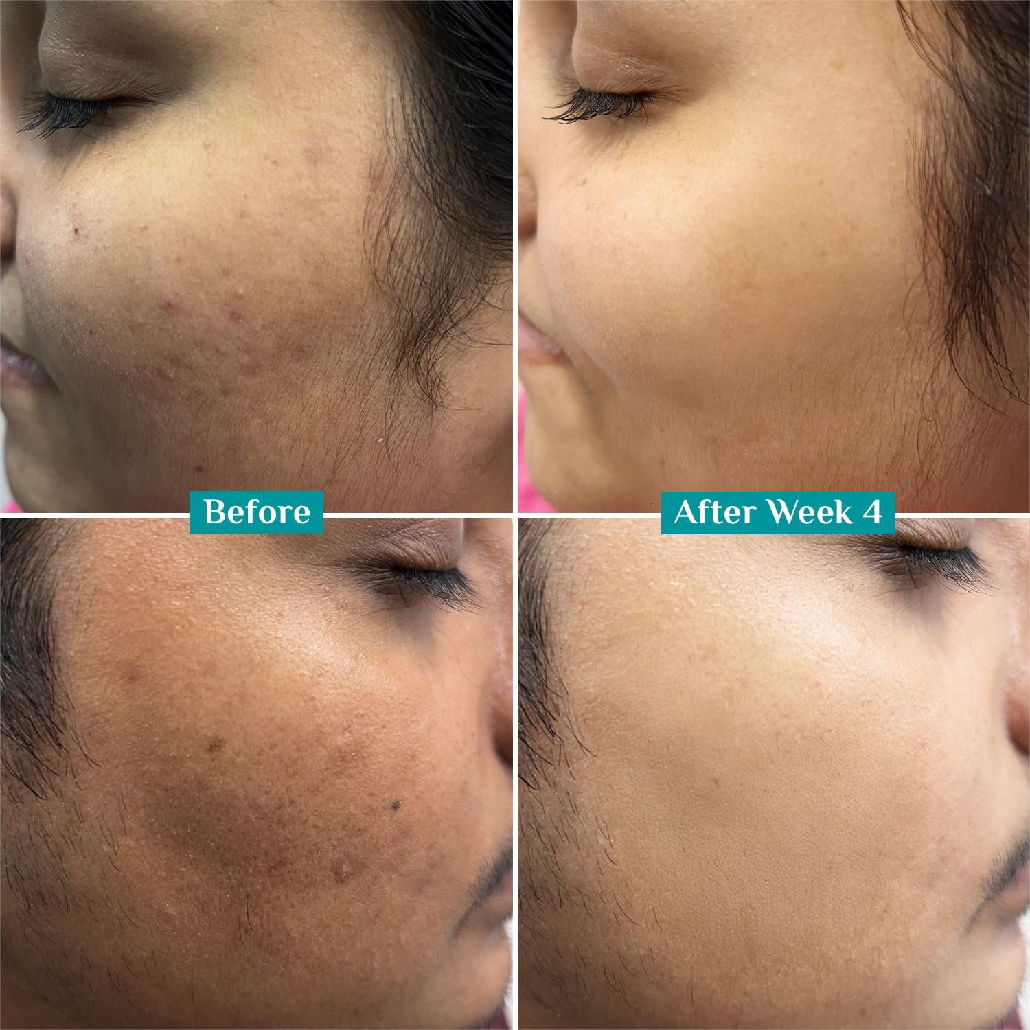 Pilgrim 10% Vitamin C Serum 30ml for Glowing Skin|With 5% Niacinamide, Hyaluronic & Glycolic Acid|Fades Dark Spots, Pigmentation|For All, Oily, Combination, Normal Skin |Beginner Friendly - Men, Women - Image 8